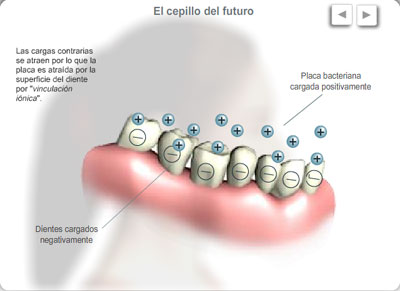 dientes en - y placa en +, luego boca llena de mugre.